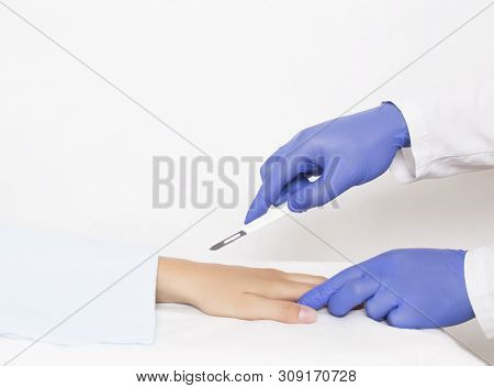 Dotcore Surgeon Holds A Scalpel Near The Radiocarpal Joint On The Girl S Arm, The Concept Of Operati
