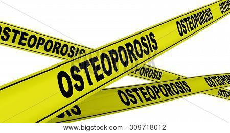 Osteoporosis. Yellow Warning Tapes With Black Words Osteoporosis (is A Disease In Which Bone Weakeni