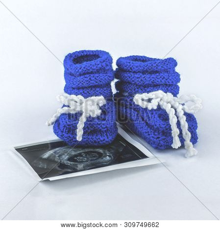 It Is A Boy. Pregnancy. Waiting For A Baby. Blue Slippers With A Photo Of Ultrasound On A White Back