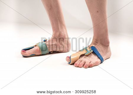 Stabilizing Orthosis For The Correction Of The Big Toe On The Woman Legs When Hallux Valgus, 2 Legs,