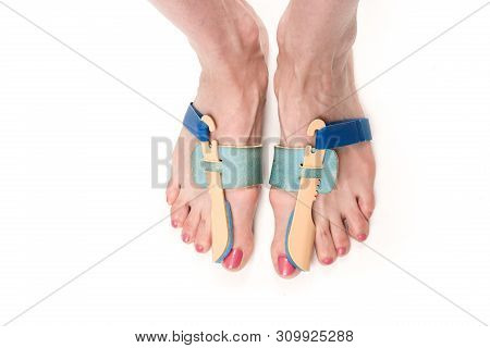 Stabilizing Orthosis For The Correction Of The Big Toe On The Woman Legs When Hallux Valgus, 2 Legs,