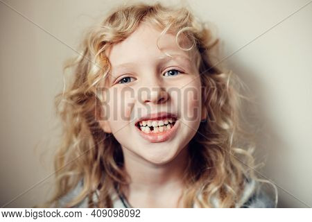 Closeup Of Smiling Caucasian Blonde Girl Showing Her Missing Lost Milk Tooth. Dental Oral Health Hyg