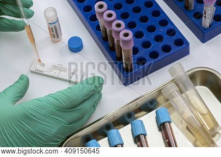 Nurse Analyses Positive Pcr Test Of Covid-19 In A Hospital Laboratory, Conceptual Image