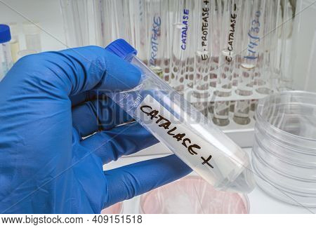 Ntist Holds Vial With Catalase Enzyme That Helps Regulate  Cytokine Production, Protects Oxidative I