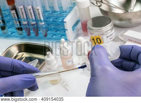 Hematological Analysis With Forensic Test Kit In A Murder In A Crime Lab, Positive For Human Blood, 