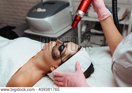 the procedure is carbon peeling, the girl is lying on the couch and the doctor is behind her