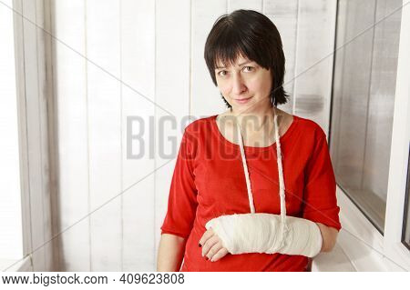 A Broken Arm. Close-up Of The Plaster. A Lady In A Red Jacket With A Bright Manicure. Exercises To R