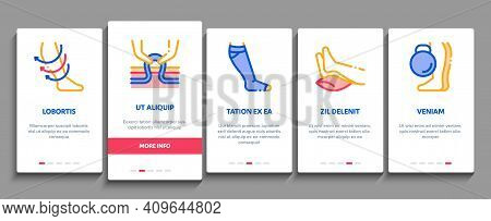 Varicose Veins Disease Onboarding Mobile App Page Screen Vector. Varicose Symptoms And Treatment, Le