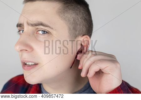 A Man Whose Ear Is Bleeding. Vascular Rupture, Damage To The Tympanic Membrane, Ear Diseases, Oncolo