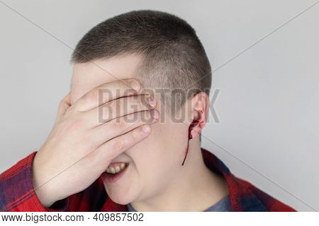 A Man Whose Ear Is Bleeding. Vascular Rupture, Damage To The Tympanic Membrane, Ear Diseases, Oncolo