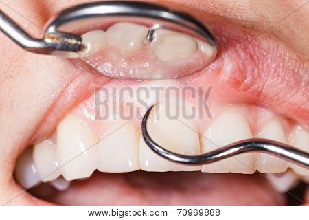 Dental Examination