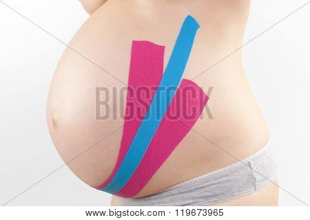 Kinesio Tape On Pregnant.
