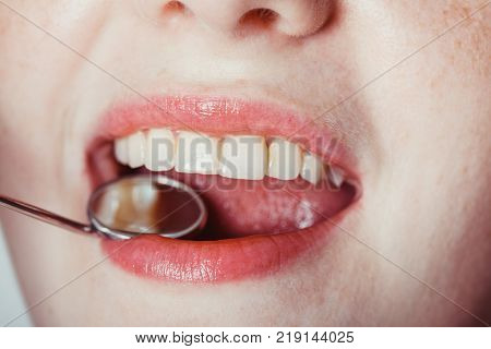 Open mouth of woman with dentist mirror during checking teeth