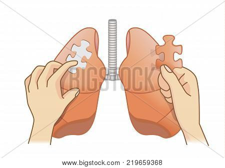Hand holding last piece of jigsaw puzzle for add on the lung. Medical concept illustration about treatment for danger disease.