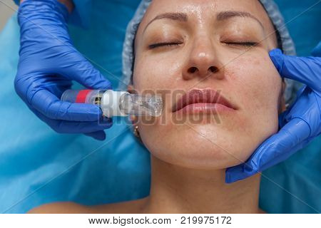 Cosmetic treatment by injection in the clinic. Use of a dermal injector to stimulate the skin. A woman receives injections of a placental-peptide serum