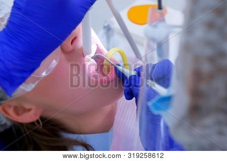 Dental Hygienist Makes Ultrasonic Cleaning Teeth To Woman In Dentistry, Closeup View. Patient Woman 