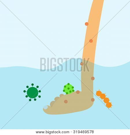 Flood Disease. Foot Infacted. Bacteria In Water. Dirty Water
