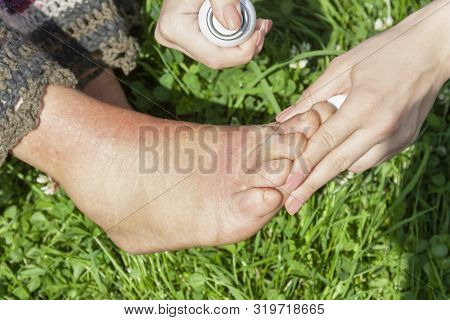 A Girl Treats The Elder Woman Who Got A Scald Of Leg