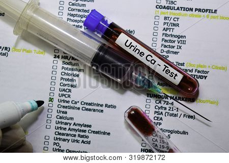 Urine Ca (creatinine Ratio) - Test With Blood Sample. Top View Isolated On Office Desk. Healthcare/m