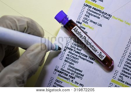 Alkaline Phosphatase - Test With Blood Sample. Top View Isolated On Office Desk. Healthcare/medical 