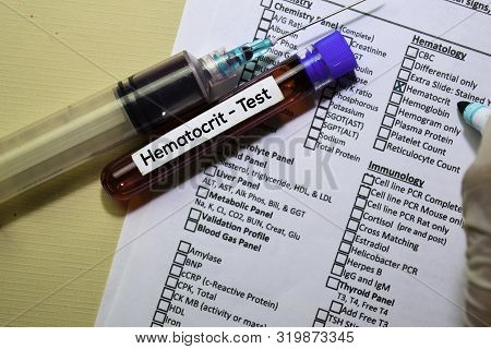 Hematocrit - Test With Blood Sample. Top View Isolated On Office Desk. Healthcare/medical Concept