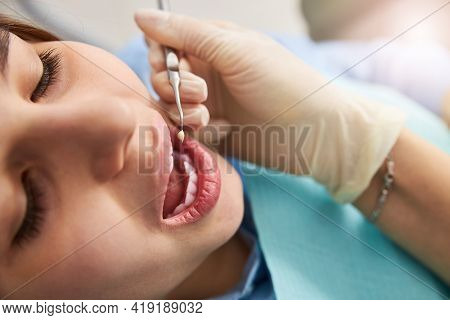 Patient With Opened Mouth Ready For Dental Restoration With Plugger