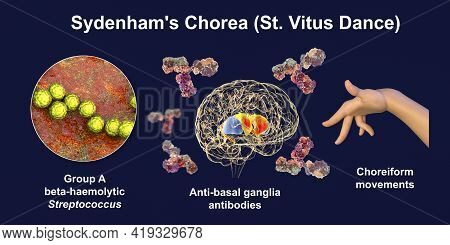 Sydenham's Chorea, An Autoimmune Disease That Results From Streptococcus Infection, Formation Of Ant