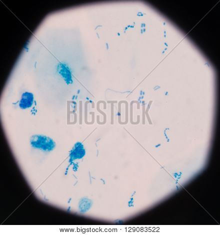 background Blue bacteria in gram stain sputum.
