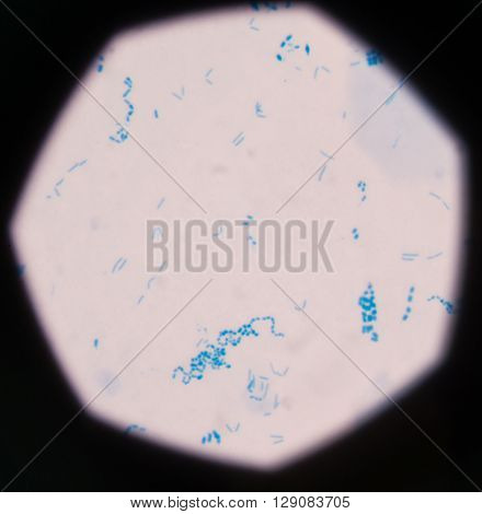 background Blue bacteria in gram stain sputum.