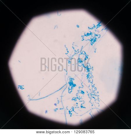 background Blue bacteria in gram stain sputum.