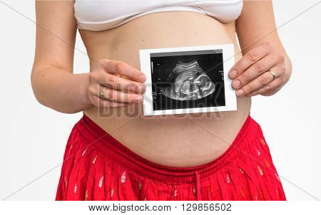 Belly of a pregnant woman and ultrasound with baby isolated on white background