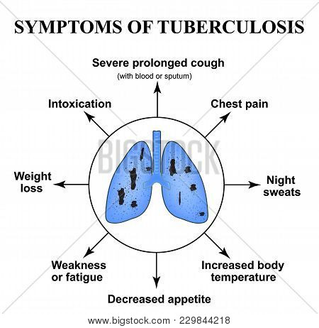 Symptoms Of Tuberculosis. World Tuberculosis Day. March 24. The Structure Of The Lungs. Infographics