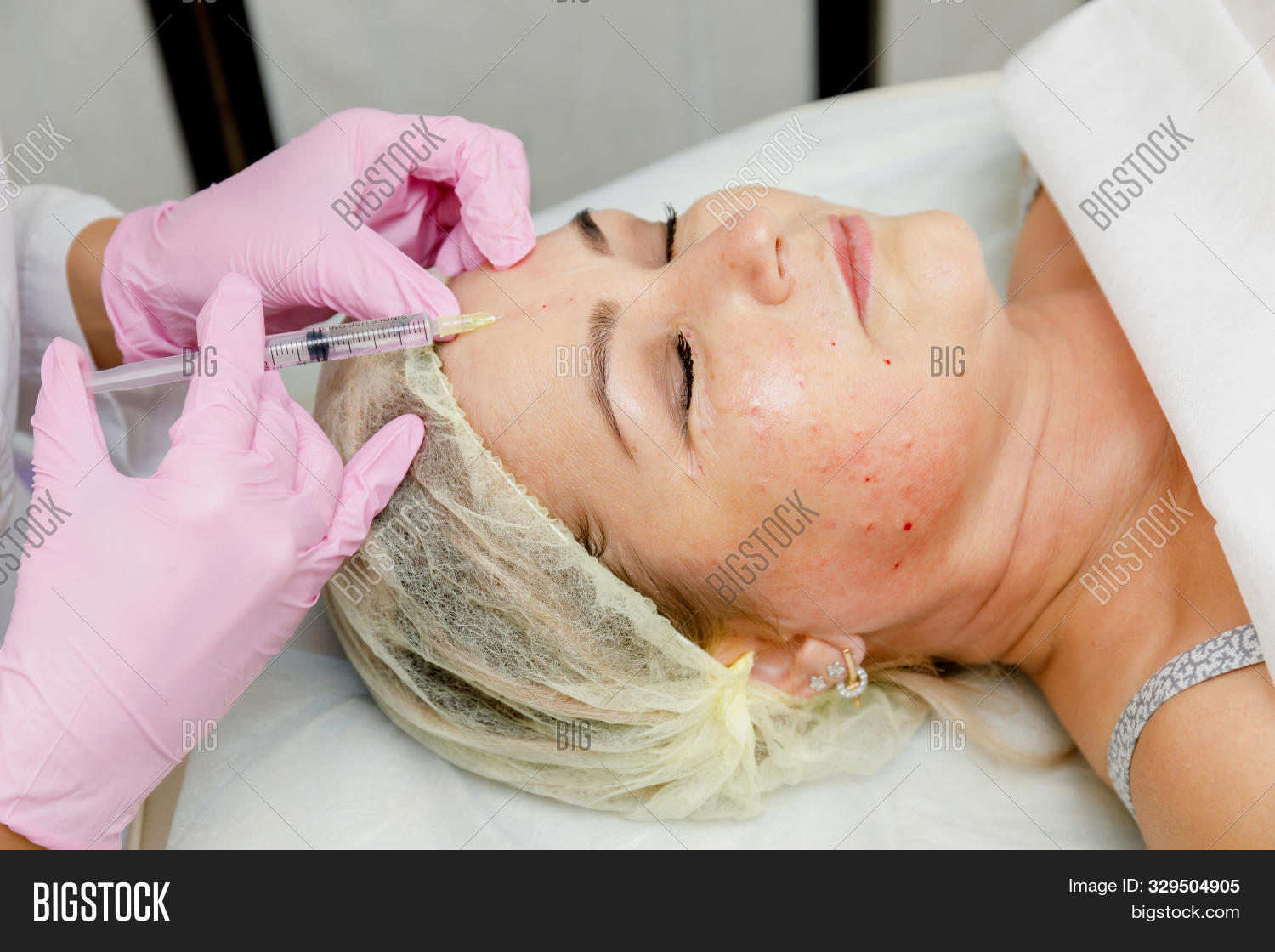 Контурная пластика и ботулинотерапия. Инъекции ботокса. Ботулинотерапия ботокс. Инъекции красоты. Инъекционная мезотерапия.