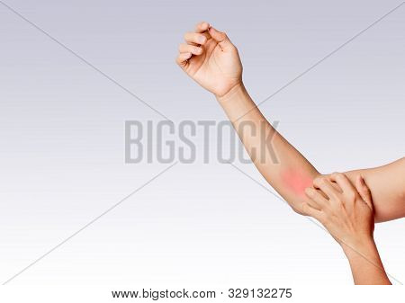 left hand scratching right arm around elbow joint