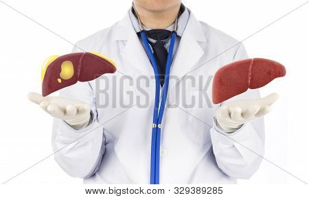 Doctor Touch Fatty On Liver , Concept Fatty Liver