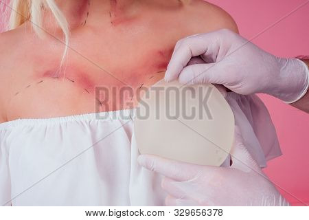 Flawless Face Of Young Beautiful Blonde Long Hair Patient Woman And Doctor Surgery Consulting About 