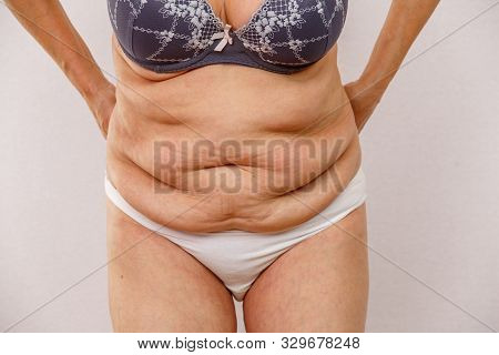 An Elderly Woman In White Panties Shows The Folds On Her Abdomen On A White Isolated Background.