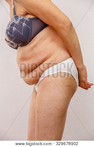 An Elderly Woman In White Panties Shows The Folds On Her Abdomen On A White Isolated Background.