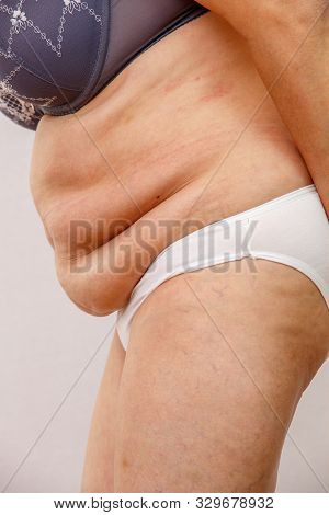 An Elderly Woman In White Panties Shows The Folds On Her Abdomen On A White Isolated Background.