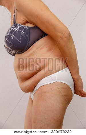 An Elderly Woman In White Panties Shows The Folds On Her Abdomen On A White Isolated Background.