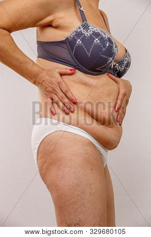 An Elderly Woman In White Panties Shows The Folds On Her Abdomen On A White Isolated Background.