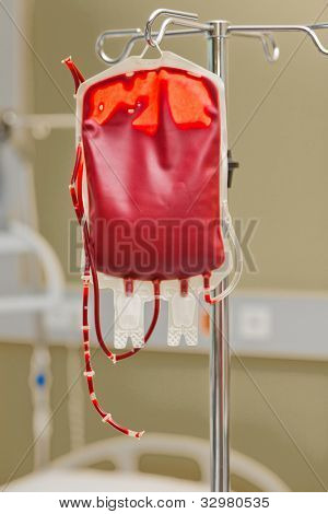 um saco de sangue para infusão em uma clínica. dador de sangue é administrado.