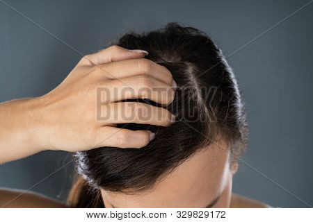 Young Woman Scratching Her Itchy Head Scalp