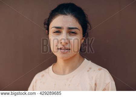 Stressed Woman Suffering Of Heatstroke Refreshing With Cold Water Outside. Weather Abnormal Exreme H