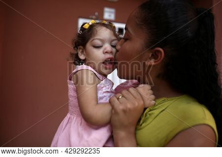 Mother With Daughter With Microcephaly