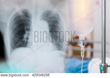 X-ray Image Of Human Lungs For A Medical Coronavirus Covid-19 Diagnosis. And Normal Saline Solution
