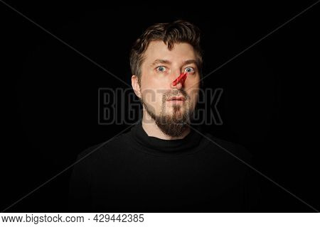 Bearded Man With Clothespin On Nose. Bad Stink, Funny Prankster, Joke Concept. Laugh At Yourself. Re