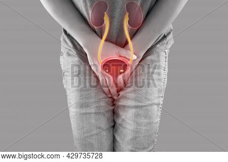 A Man Having Urethritis. Male With Hands Holding Her Crotch. Bladder Stones In Men