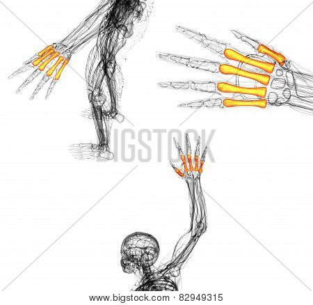 3D Render Medical Illustration Of The Metacarpal Bone
