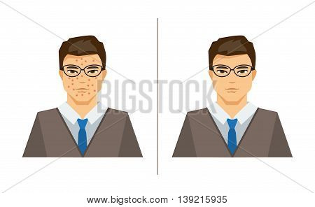 Illustration on medical theme a man with pimples and a man with healthy skin